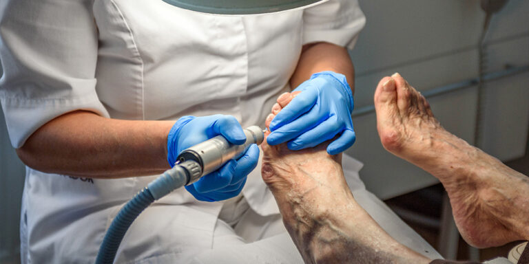 Cirugia de uña encarnada en el Cenro Médico del Pie Dra. Rita Rottier