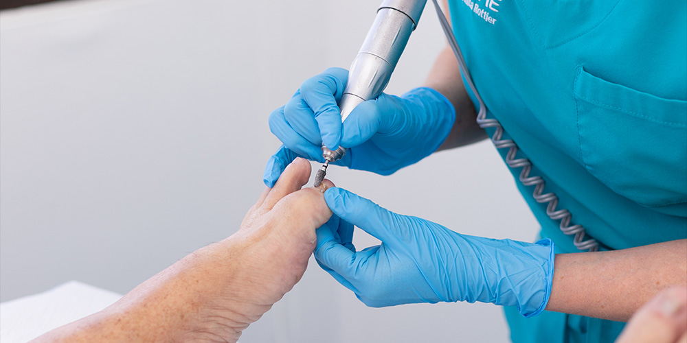 Tratamiento de reconstrucción de uñas en el Centro Médico del Pie Dra. Rita Rottier